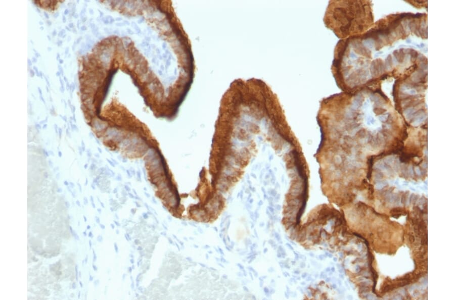 Immunohistochemistry - Anti-MUC1 Antibody [SPM493] (A249409) - Antibodies.com