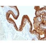 Immunohistochemistry - Anti-MUC1 Antibody [SPM493] (A249409) - Antibodies.com