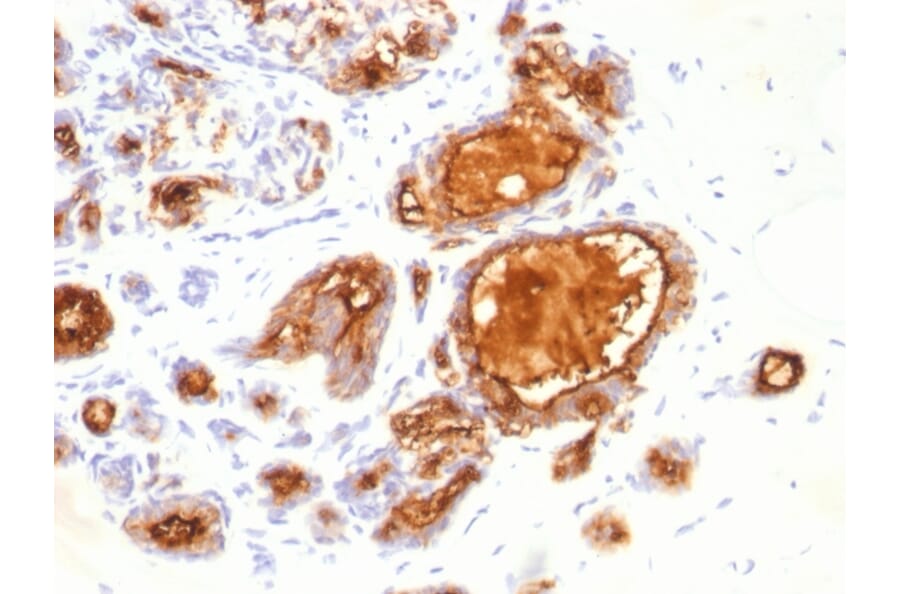 Immunohistochemistry - Anti-MUC1 Antibody [115D8] (A249410) - Antibodies.com