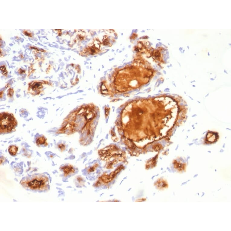 Immunohistochemistry - Anti-MUC1 Antibody [115D8] (A249410) - Antibodies.com