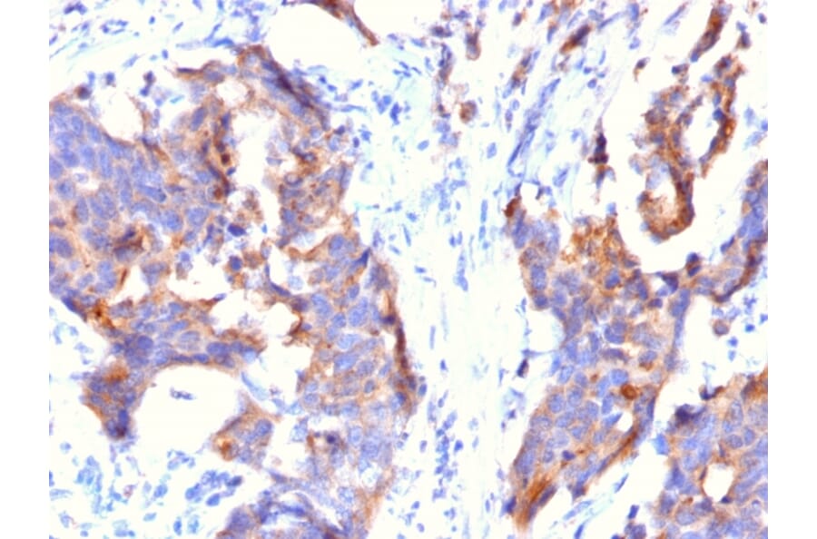 Immunohistochemistry - Anti-MUC1 Antibody [115D8] (A249411) - Antibodies.com