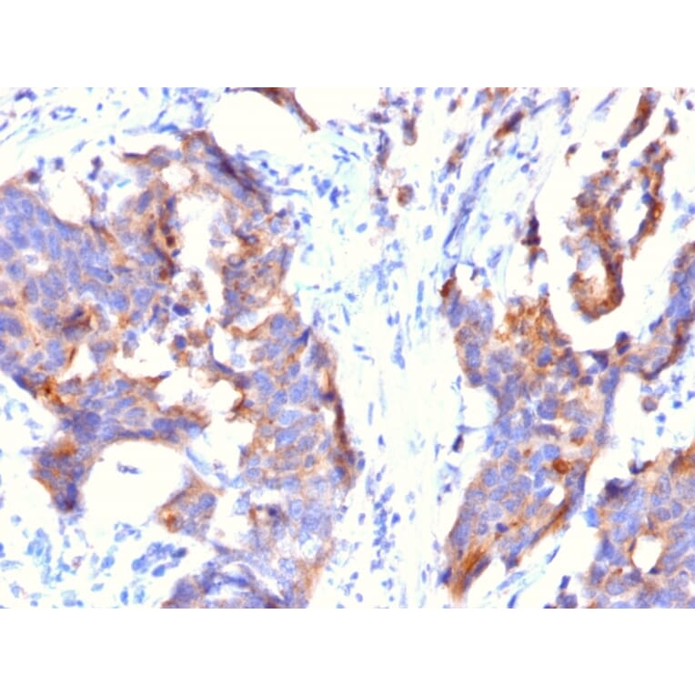 Immunohistochemistry - Anti-MUC1 Antibody [115D8] (A249411) - Antibodies.com