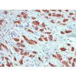 Immunohistochemistry - Anti-MUC1 Antibody [MUC1/1887R] (A249411) - Antibodies.com