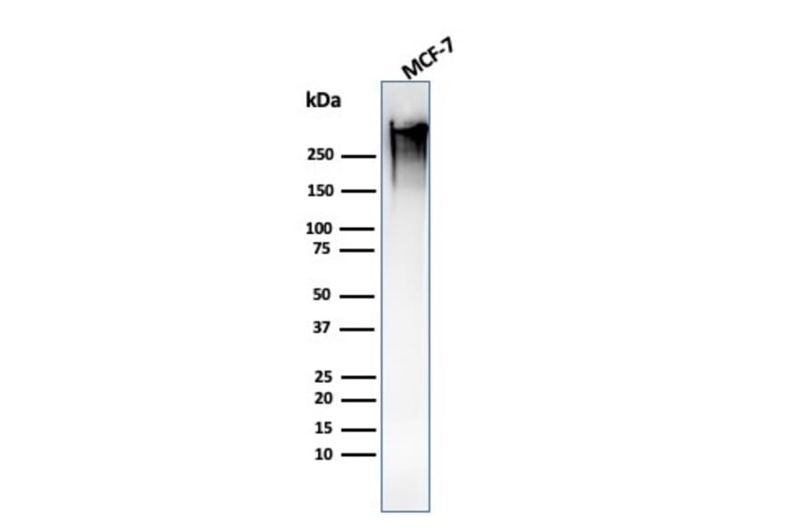 Western Blot - Anti-MUC1 Antibody [MUC1/1887R] (A249412) - Antibodies.com
