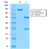 SDS-PAGE - Anti-MUC1 Antibody [MUC1/2278R] (A252592) - Antibodies.com