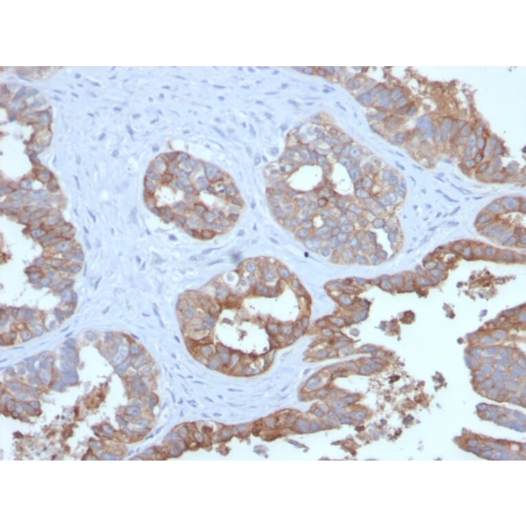 Immunohistochemistry - Anti-MUC1 Antibody [MUC1/2729R] (A249413) - Antibodies.com