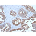 Immunohistochemistry - Anti-MUC1 Antibody [MUC1/2729R] (A249413) - Antibodies.com