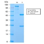 SDS-PAGE - Anti-MUC1 Antibody [MUC1/2729R] (A249414) - Antibodies.com