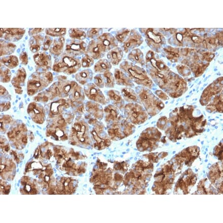 Immunohistochemistry - Anti-MUC1 Antibody [MUC1/2818R] (A249415) - Antibodies.com