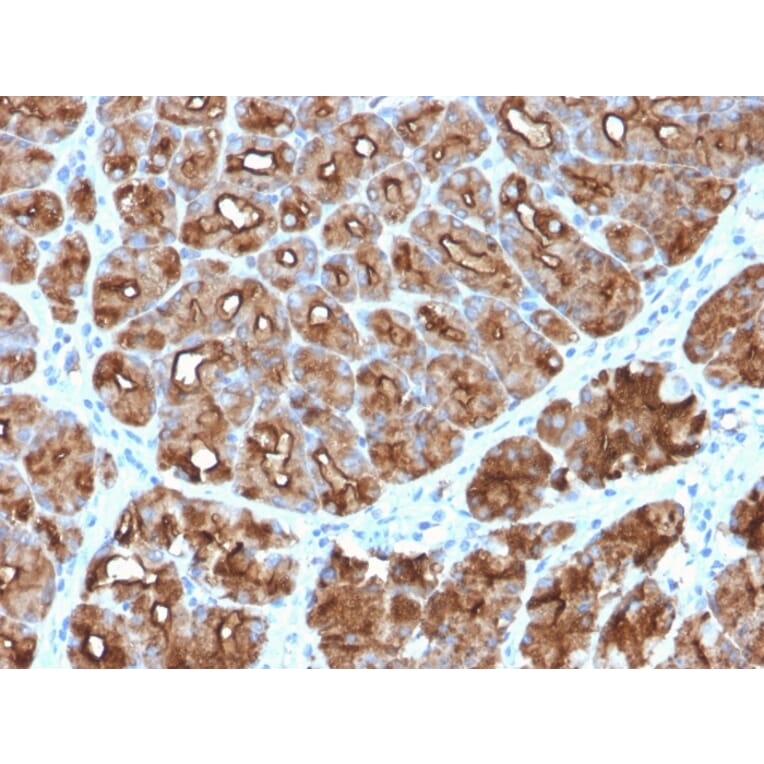 Immunohistochemistry - Anti-MUC1 Antibody [MUC1/2818R] (A249415) - Antibodies.com