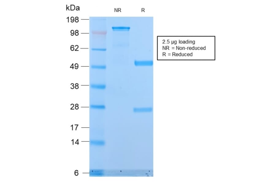 SDS-PAGE - Anti-MUC1 Antibody [MUC1/2818R] (A249415) - Antibodies.com