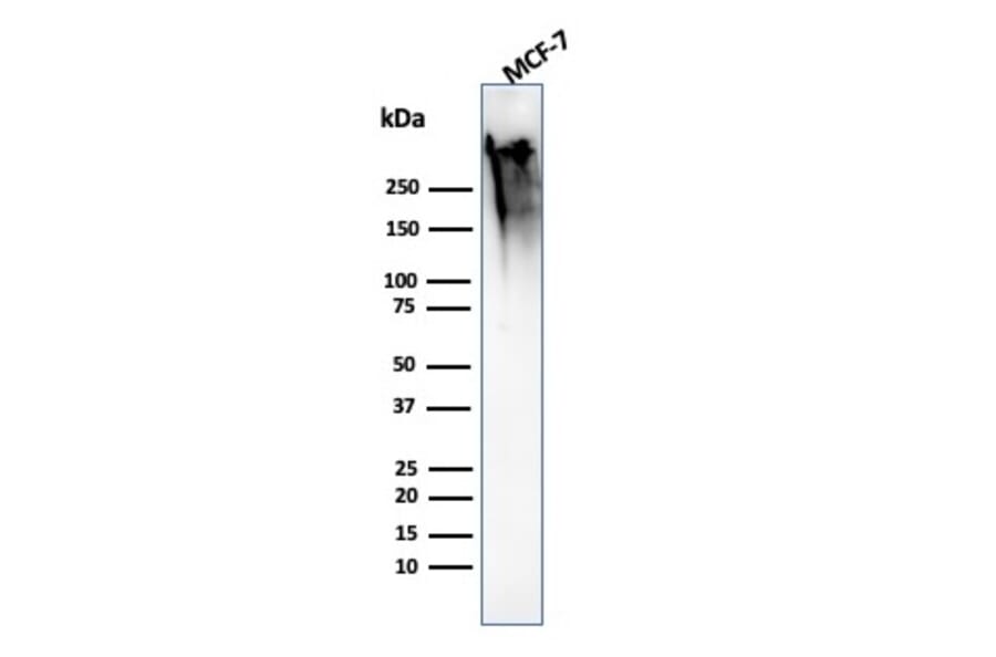 Western Blot - Anti-MUC1 Antibody [MUC1/2818R] (A249415) - Antibodies.com
