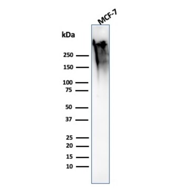 Western Blot - Anti-MUC1 Antibody [MUC1/2818R] (A249415) - Antibodies.com