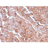 Immunohistochemistry - Anti-MUC1 Antibody [MUC1/2980R] (A252586) - Antibodies.com