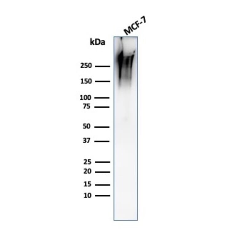 Western Blot - Anti-MUC1 Antibody [MUC1/2980R] (A252595) - Antibodies.com