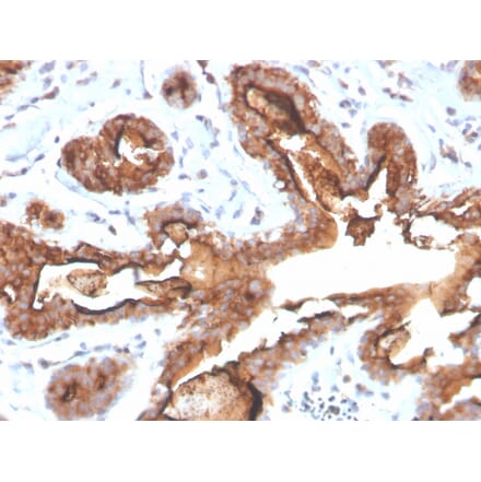 Immunohistochemistry - Anti-MUC1 Antibody [MUC1/4416R] (A249417) - Antibodies.com