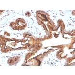 Immunohistochemistry - Anti-MUC1 Antibody [MUC1/4416R] (A249417) - Antibodies.com