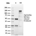 SDS-PAGE - Anti-MUC1 Antibody [MUC1/4416R] (A249417) - Antibodies.com