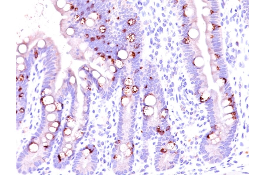 Immunohistochemistry - Anti-MUC2 Antibody [CCP58] (A249418) - Antibodies.com