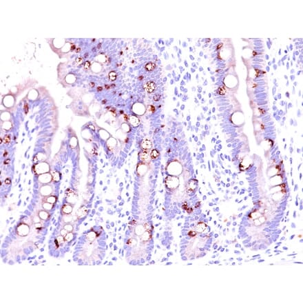 Immunohistochemistry - Anti-MUC2 Antibody [CCP58] (A249418) - Antibodies.com