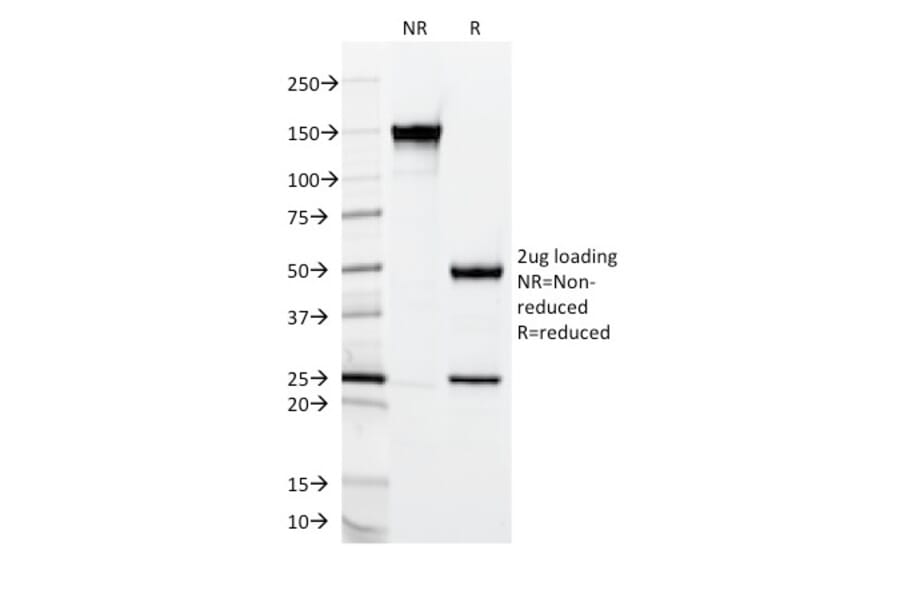 SDS-PAGE - Anti-MUC2 Antibody [CCP58] (A249418) - Antibodies.com