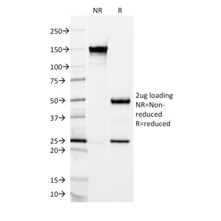 SDS-PAGE - Anti-MUC2 Antibody [CCP58] (A249418) - Antibodies.com