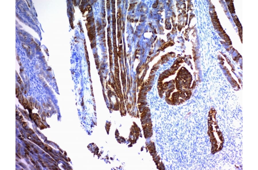 Immunohistochemistry - Anti-MUC2 Antibody [SPM296] (A249418) - Antibodies.com