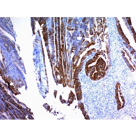 Immunohistochemistry - Anti-MUC2 Antibody [SPM296] (A249418) - Antibodies.com
