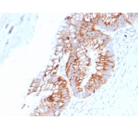 Immunohistochemistry - Anti-MUC2 Antibody [SPM513] (A249419) - Antibodies.com