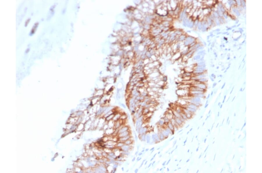 Immunohistochemistry - Anti-MUC2 Antibody [SPM513] (A249419) - Antibodies.com