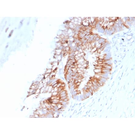 Immunohistochemistry - Anti-MUC2 Antibody [SPM513] (A249419) - Antibodies.com