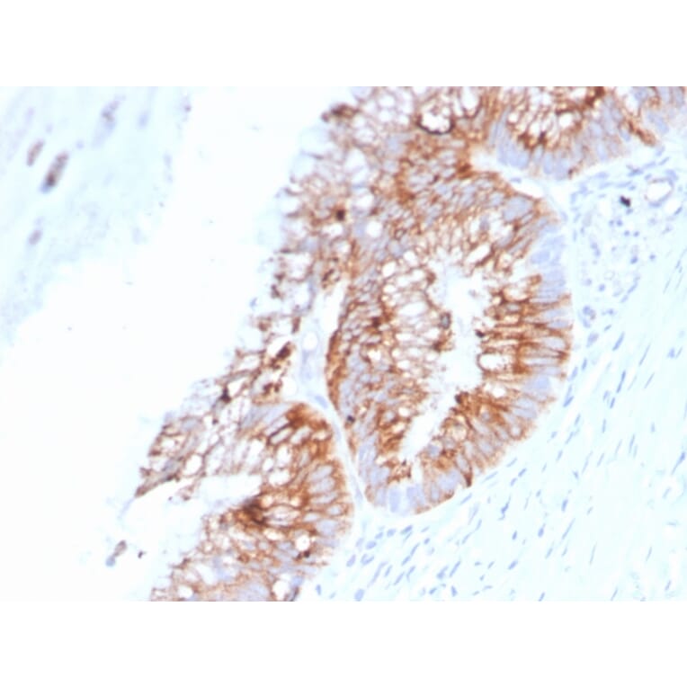 Immunohistochemistry - Anti-MUC2 Antibody [SPM513] (A249419) - Antibodies.com