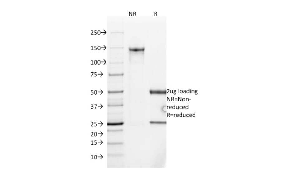 SDS-PAGE - Anti-MUC2 Antibody [SPM513] (A249420) - Antibodies.com