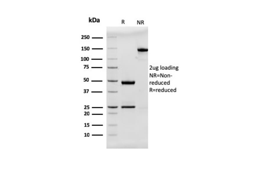 SDS-PAGE - Anti-MUC2 Antibody [rMLP/842] (A249422) - Antibodies.com