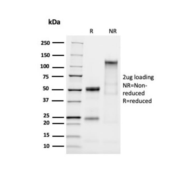 SDS-PAGE - Anti-MUC2 Antibody [MLP/2970R] (A249423) - Antibodies.com