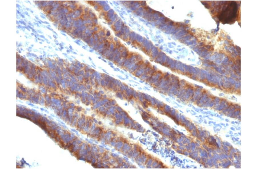 Immunohistochemistry - Anti-MUC3 Antibody [M3.1] (A249423) - Antibodies.com