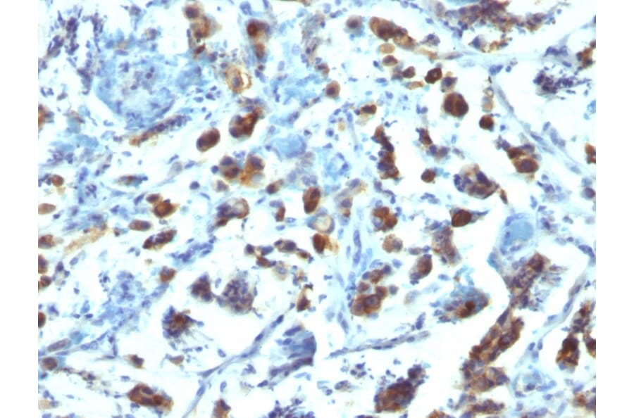 Immunohistochemistry - Anti-MUC3 Antibody [SPM200] (A249424) - Antibodies.com