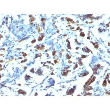 Immunohistochemistry - Anti-MUC3 Antibody [SPM200] (A249424) - Antibodies.com