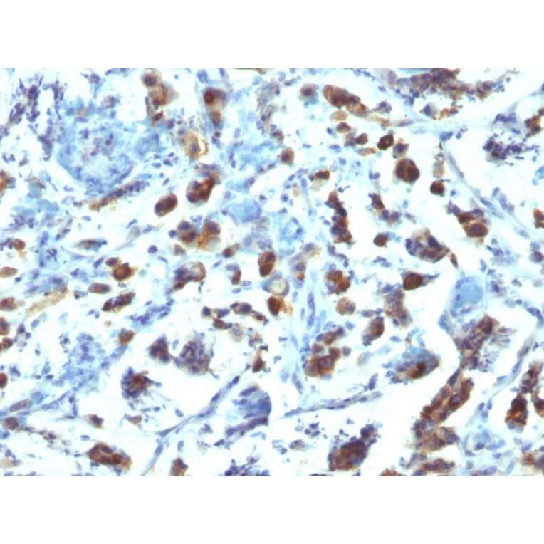 Immunohistochemistry - Anti-MUC3 Antibody [SPM200] (A249424) - Antibodies.com