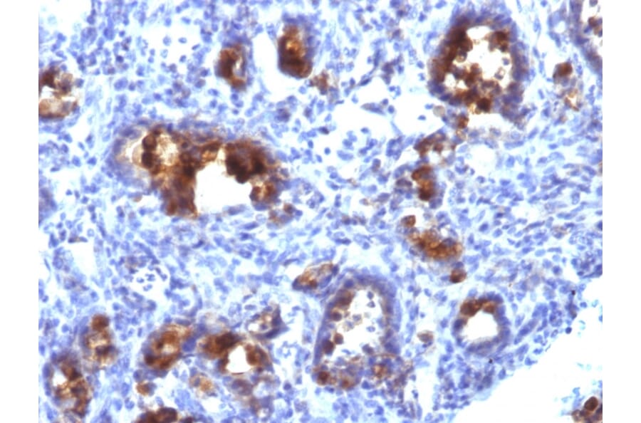Immunohistochemistry - Anti-MUC3 Antibody [MUC3/1154] (A249426) - Antibodies.com