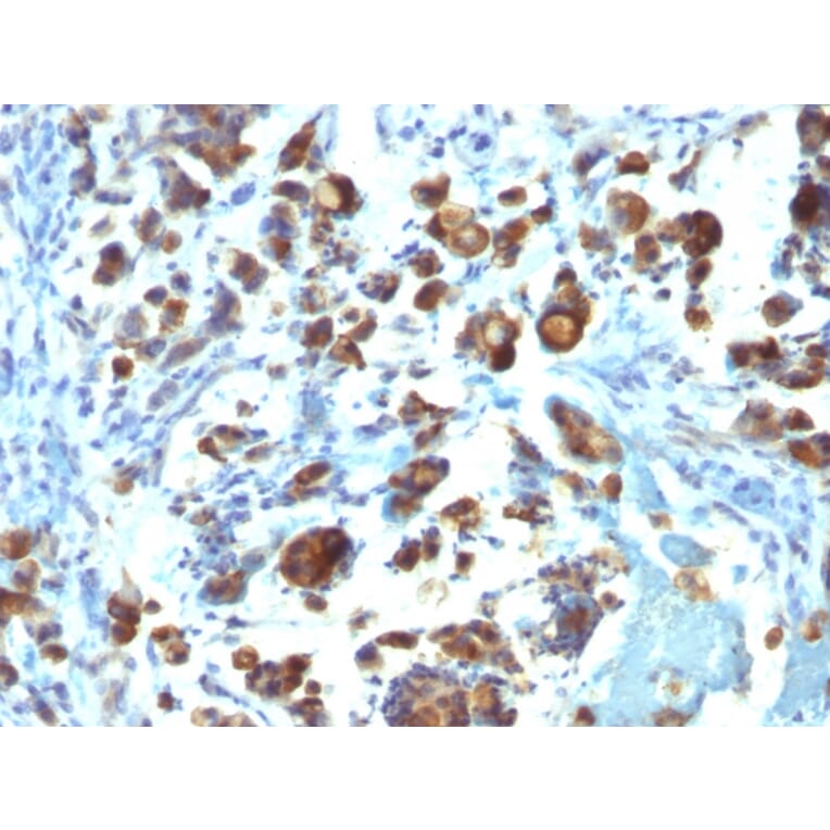 Immunohistochemistry - Anti-MUC3 Antibody [MUC3/1154] (A249426) - Antibodies.com