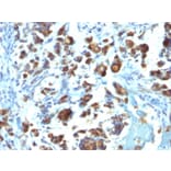 Immunohistochemistry - Anti-MUC3 Antibody [MUC3/1154] (A249426) - Antibodies.com