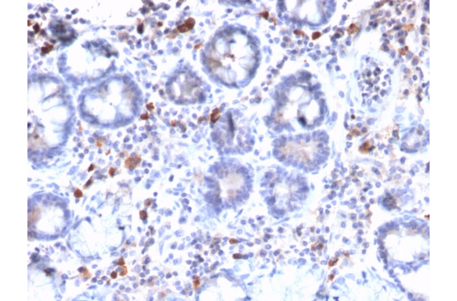 Immunohistochemistry - Anti-MUC3 Antibody [MUC3/2992R] (A249426) - Antibodies.com