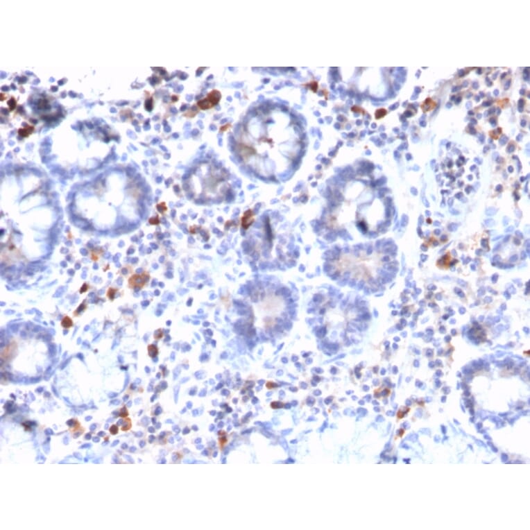 Immunohistochemistry - Anti-MUC3 Antibody [MUC3/2992R] (A249426) - Antibodies.com