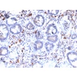 Immunohistochemistry - Anti-MUC3 Antibody [MUC3/2992R] (A249426) - Antibodies.com
