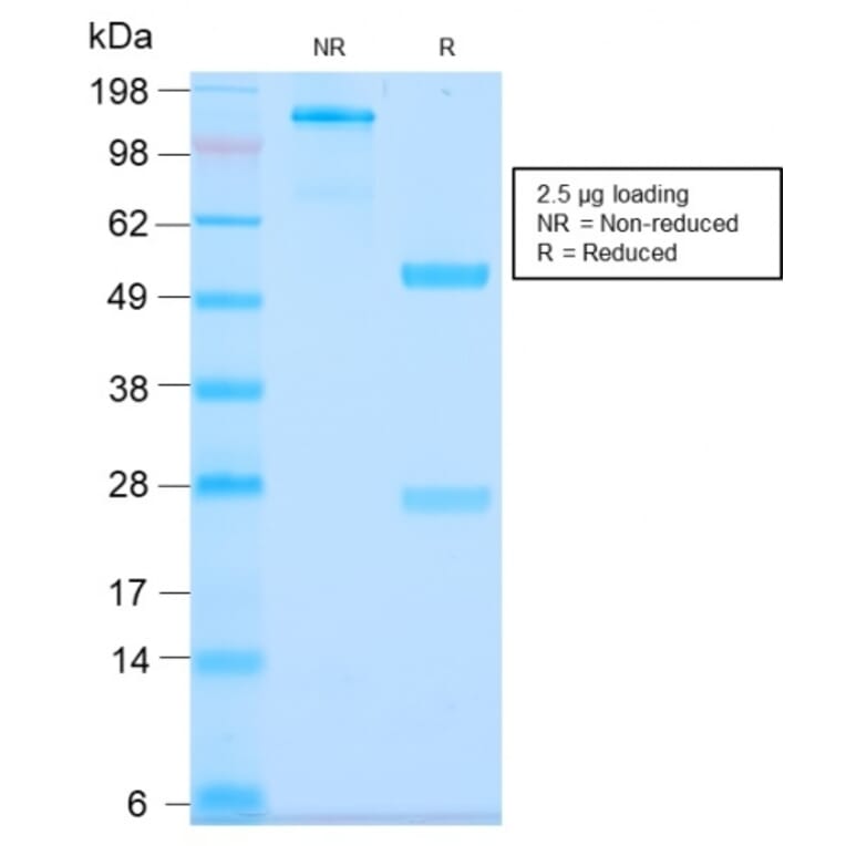 SDS-PAGE - Anti-MUC3 Antibody [MUC3/2992R] (A249427) - Antibodies.com