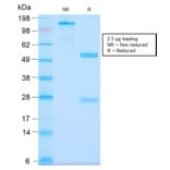 SDS-PAGE - Anti-MUC3 Antibody [MUC3/2992R] (A249427) - Antibodies.com