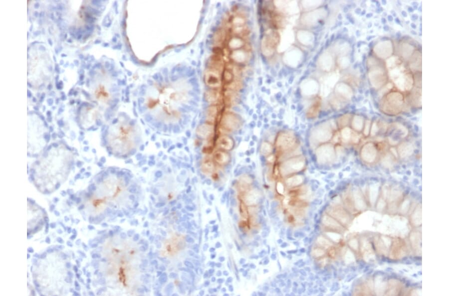 Immunohistochemistry - Anti-MUC4 Antibody [MUC4/3084] (A249428) - Antibodies.com