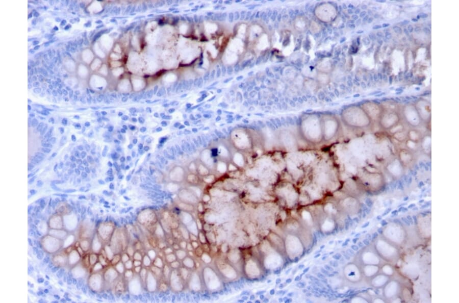 Immunohistochemistry - Anti-MUC4 Antibody [MUC4/3084] (A249428) - Antibodies.com