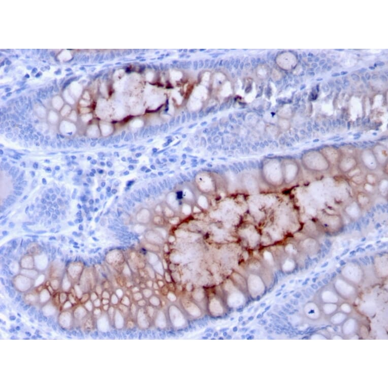 Immunohistochemistry - Anti-MUC4 Antibody [MUC4/3084] (A249428) - Antibodies.com
